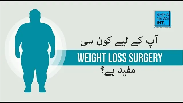 Comparison of the types of weight loss surgery
